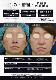 施術×点滴×内服